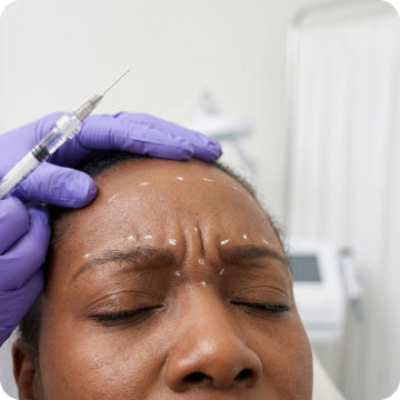 Marking injection points for anti wrinkle treatment at Alexis Aesthetics